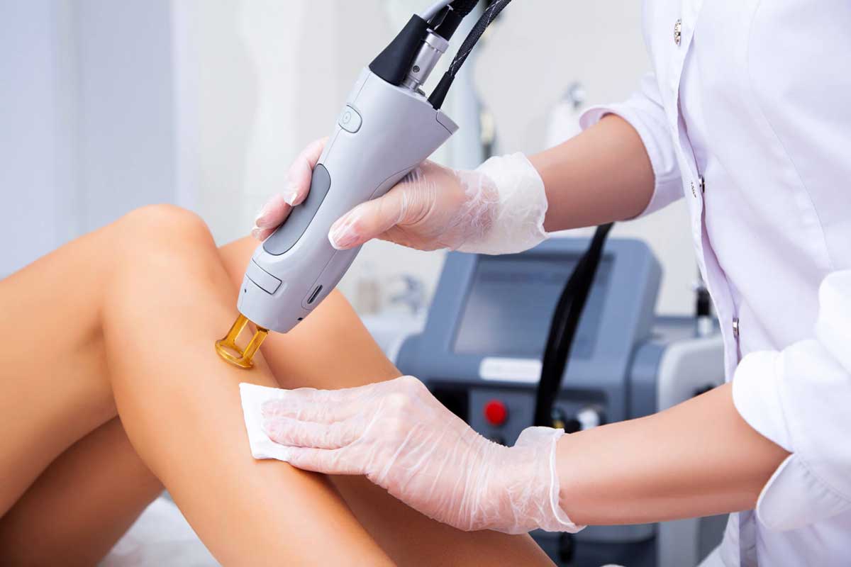 The Top 8 Benefits of Laser Hair Removal Treatment