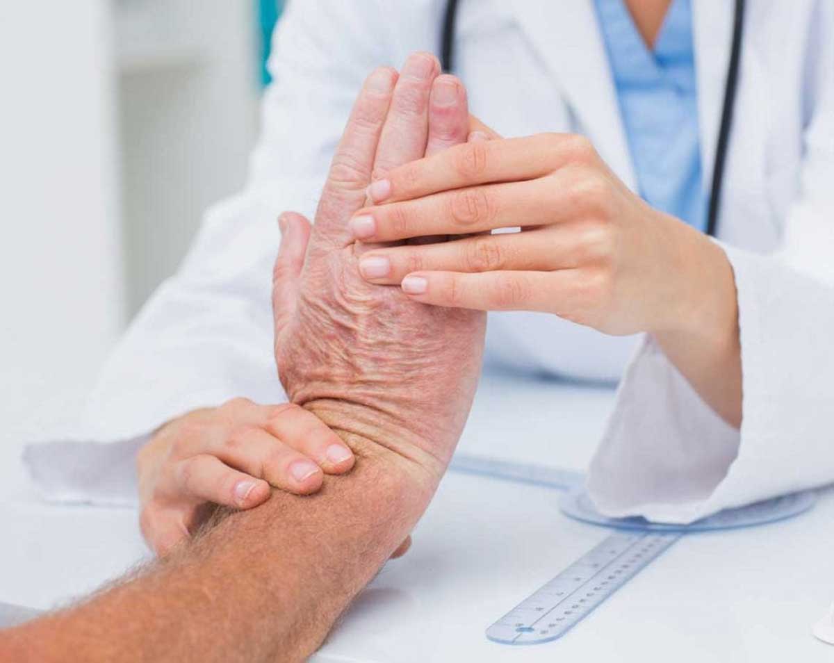 Treating Dupuytren’s Contracture